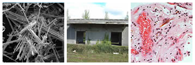 Close up of Asbestos Fibres, Asbestos Roof